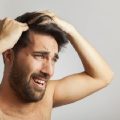 Alopecia nervosa - homem preocupado com a queda de cabelo na linha de crescimento do cabelo