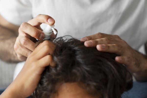 Aplicação de tratamento no cabelo do homem