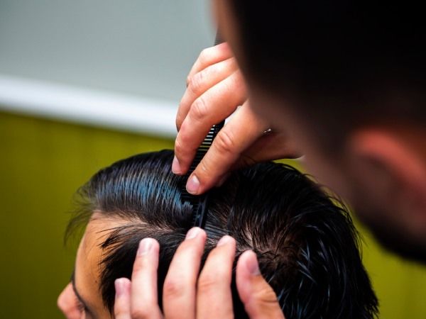 Revisão do couro cabeludo após transplante de cabelo