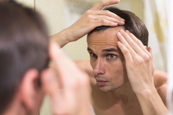 cabelo de aliciamento de homem após implante capilar 