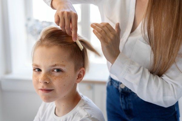 Mulher penteando o cabelo do menino para esconder as sinais de alopecia - Alopecia em crianças 