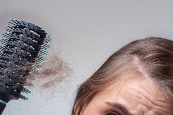 Conceito de queda de cabelo - Espironolactona para alopecia feminina