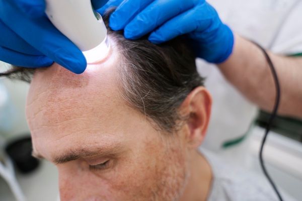 Homem recebendo resposta de seu dermatologista á pergunta: existem testes para diagnosticar a alopecia?
