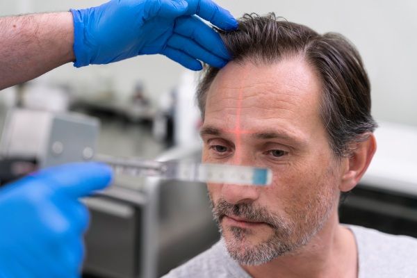 Homem recebendo tratamento para queda de cabelo