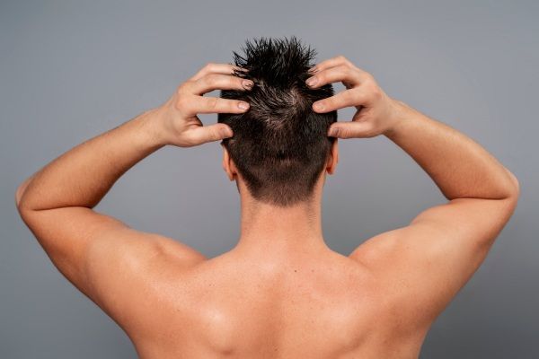 Homem de tiro médio a inflamação após o transplante capilar - dar-se uma massagem no couro cabeludo