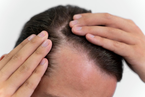 Homem adulto olhando para o cabelo