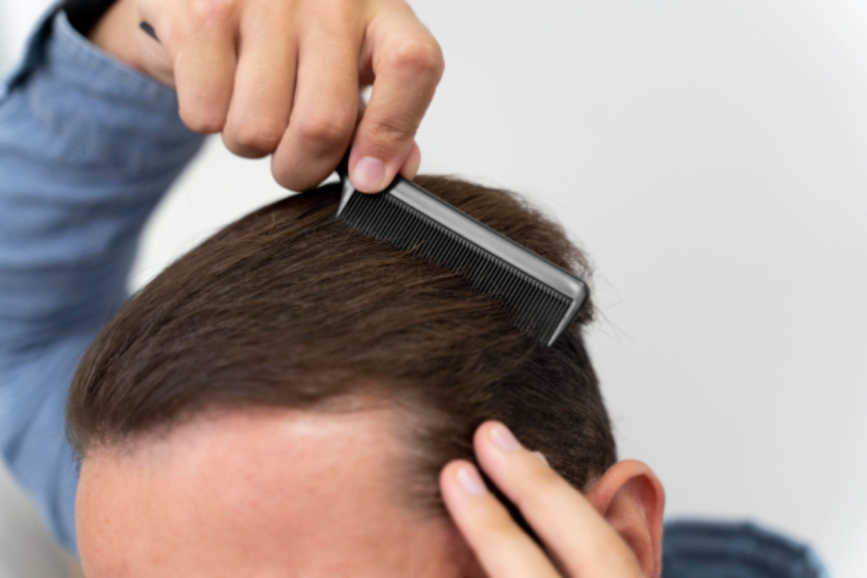 técnica de transplante capilar DHI - Macho adulto escovando o cabelo