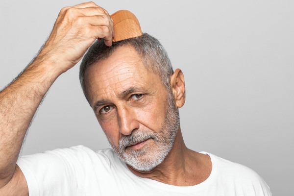 Implante capilar antes e depois - homem mais velho penteando o cabelo