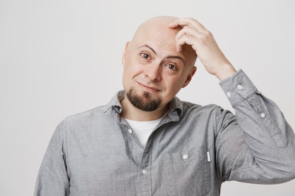 transplante capilar - Homem careca tem dúvidas sobre transplante capilar