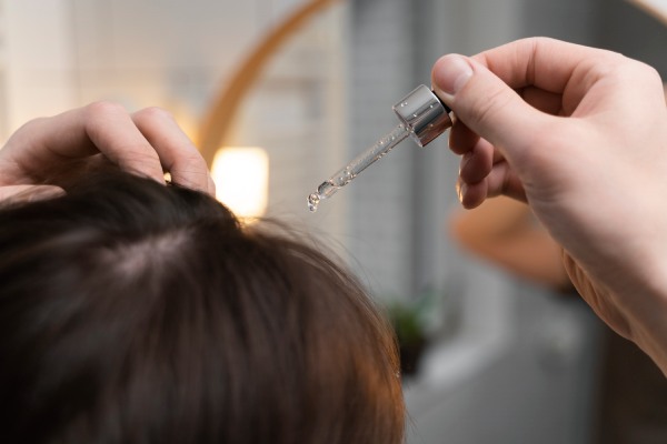 tratamentos capilares - Paciente aplicando minoxidil em seu couro cabeludo para seus problemas de alopecia