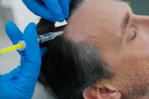 Homem no consultório de um especialista recebendo injeções em entradas de cabelo
