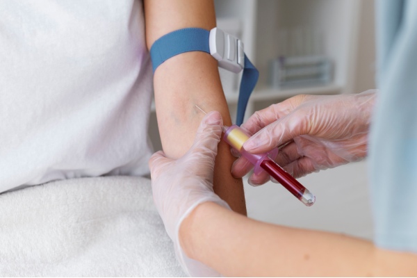 Coleta de sangue de um paciente com possível diagnóstico de hipotireoidismo