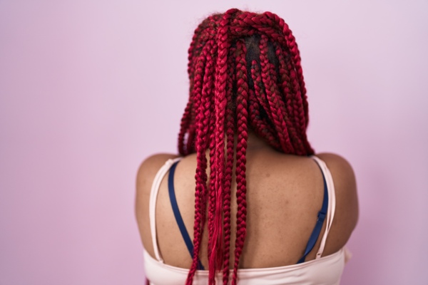 alopecia por tração - mulher com tranças no cabelo