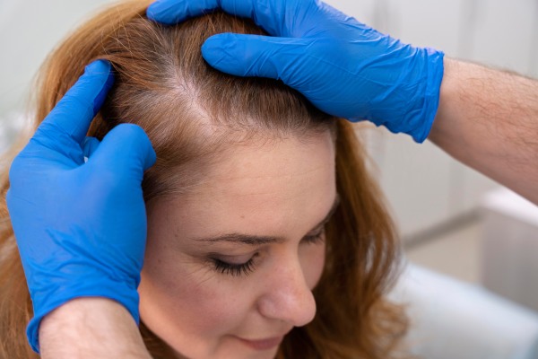 implante capilar feminino - Mulher na consulta com um tricologista, verificando a saúde do seu cabelo.